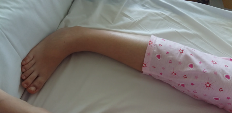Se agrava salud de niña de 13 años que recibió la vacuna contra el Papiloma Humano